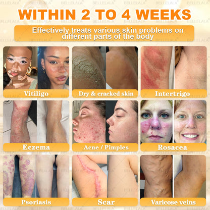 Congratulations! You have unlocked an exclusive Bellelala® offer! i As a thank you for your order, we're offering an additional 30% off today! Click below to grab this special offer, offer expires!