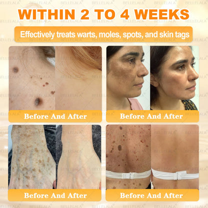 Congratulations! You have unlocked an exclusive Bellelala® offer! i As a thank you for your order, we're offering an additional 30% off today! Click below to grab this special offer, offer expires!