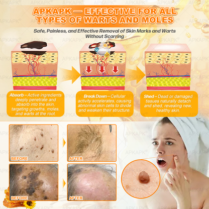 Congratulations! You have unlocked an exclusive Bellelala® offer! i As a thank you for your order, we're offering an additional 30% off today! Click below to grab this special offer, offer expires!