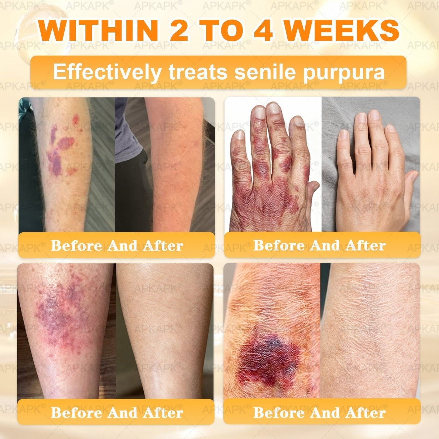 APKAPK® has a surprise upgrade just for you! You've already got an amazing offer but now you've unlocked an even better one:You'll get a massive 50% off your next purchase - for the next two minutes only!