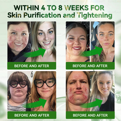 🔥Congratulations! You have unlocked an exclusive BuildLeaf® offer! i As a thank you for your order, we're offering an additional 30% off today! Click below to grab this special offer, offer expires!