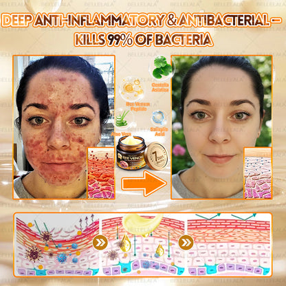 Congratulations! You have unlocked an exclusive Bellelala® offer! i As a thank you for your order, we're offering an additional 30% off today! Click below to grab this special offer, offer expires!